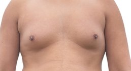 Priv. Doz. Dr. Alexandra Sibylle Fochtmann-Frana - Plastische Chirurgin Wien 1050