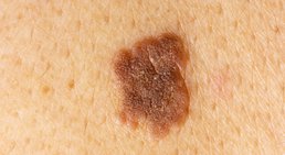 Priv. Doz. Dr. Alexandra Sibylle Fochtmann-Frana - Plastische Chirurgin Wien 1050