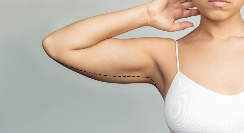 Straffungen - Priv. Doz. Dr. Alexandra Sibylle Fochtmann-Frana - Plastische Chirurgin Wien 1050