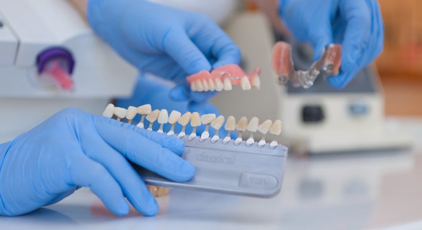 Kronen, Brücken - Dr. med. univ. Michaela Scharnagl-Lesnik - Zahnärztin Wien 1190