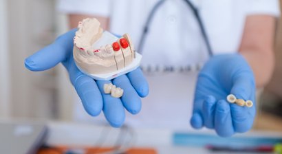 Zahnfüllung, Inlays, Onlays