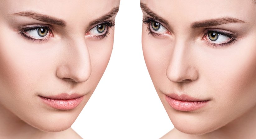 Nasenkorrekturen / Gesichtsprofilkorrekturen / Lippenkorrekturen - OA Dr. Norbert Fock - Kieferchirurg Wien 1010