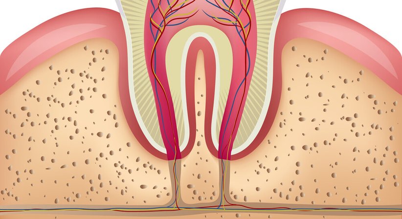 Wurzelspitzenresektion - OA Dr. Norbert Fock - Kieferchirurg Wien 1010