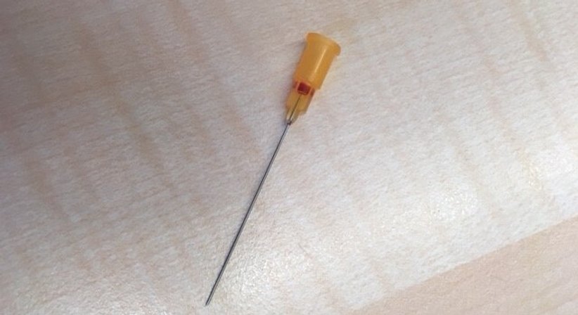 Ultraschallgezielte Feinnadelpunktion durch unsere Spezialisten. - Univ.Doz. Dr. Georg Zettinig - Nuklearmediziner Wien 1080