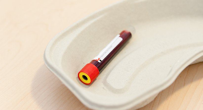 Blutabnahme selbstverständlich vor Ort - Univ.Doz. Dr. Georg Zettinig - Nuklearmediziner Wien 1080