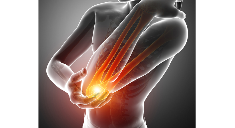 Ellbogen - OA Dr. Lukas Hold - Orthopäde Perchtoldsdorf 2380