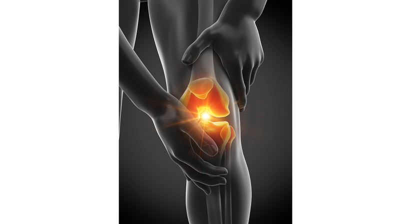 Knie - OA Dr. Lukas Hold - Orthopäde Perchtoldsdorf 2380