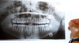 Dr. Mag. El-Nathan Shamuilov - Zahnarzt Wien 1100