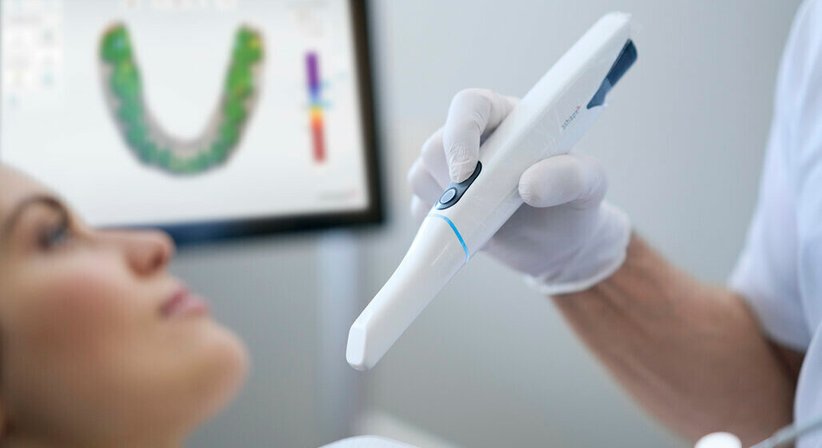 Intraoralscanner - Dr. Mag. El-Nathan Shamuilov - Zahnarzt Wien 1100