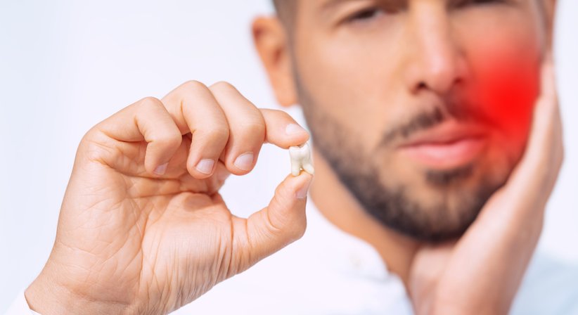 Weisheitszahnentfernung - Dr. Mag. El-Nathan Shamuilov - Zahnarzt Wien 1100