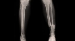 OA Dr.med.univ. Florian Frisee - Orthopäde Wien 1190