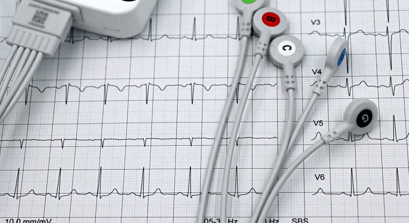 Langzeit EKG - Dr. Adrien Croizé - Internist Wiener Neustadt 2700