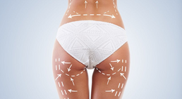 Dr. Sara Abayev - Plastische Chirurgin Wien 1060