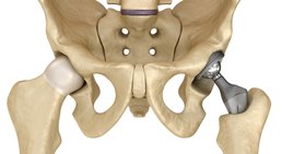 Dr. Johannes Bonomo - Orthopäde Wien 1170