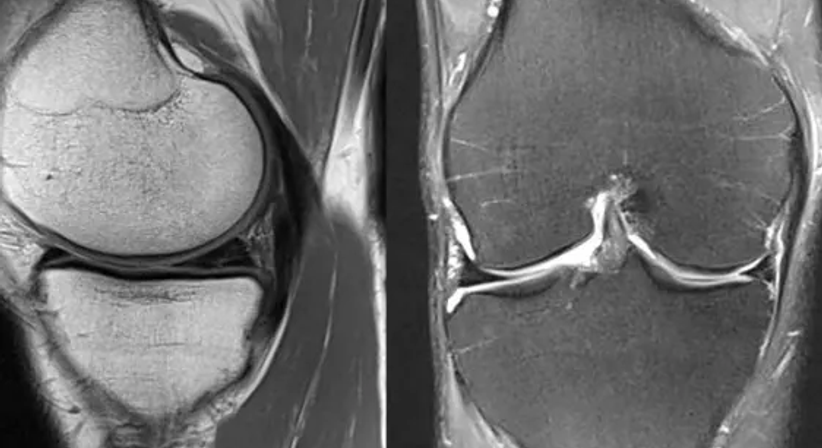 Arthroskopie - OA Dr. Clemens Hüthmair - Orthopäde Wien-Flughafen 1300