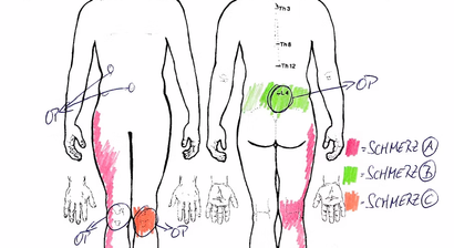Dank psychoedukativen Schmerzfragebogen den Arzttermin erfolgreich vorbereiten