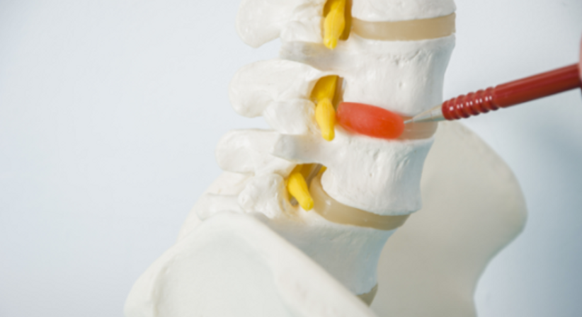 Behandlung bei Wirbelsäulenbeschwerden - Dr. Catherine Chaput - Neurologin Wien 1190