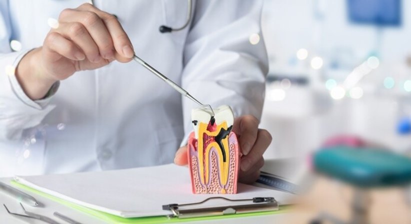 Wurzelbehandlung (Endodontie) - Dr. med. dent. Agnes Salamon - Zahnärztin Wien 1020