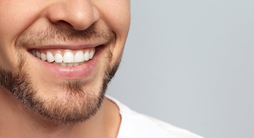 Bleaching (Zahnaufhellung) - Dr. med. dent. Agnes Salamon - Zahnärztin Wien 1020