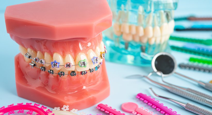 Kieferorthopädische Behandlungen - Dr. med. dent. Agnes Salamon - Zahnärztin Wien 1020