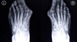 Dr. Rudolf Kramer - Orthopäde Wien 1210