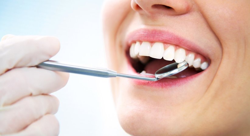 Füllungstherapie - Dr. medic stom. Leonard Victor Prisecariu - Zahnarzt Wien 1100