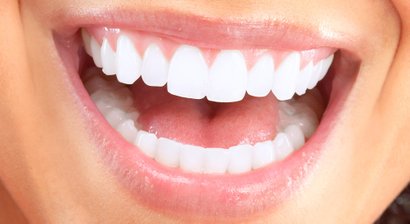 Professionelle Mundhygiene / Prophylaxe