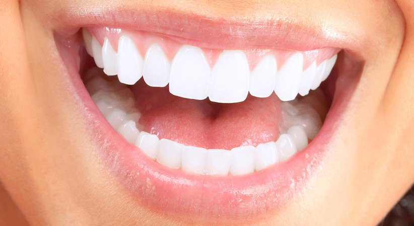 Professionelle Mundhygiene / Prophylaxe - Dr. medic stom. Leonard Victor Prisecariu - Zahnarzt Wien 1100