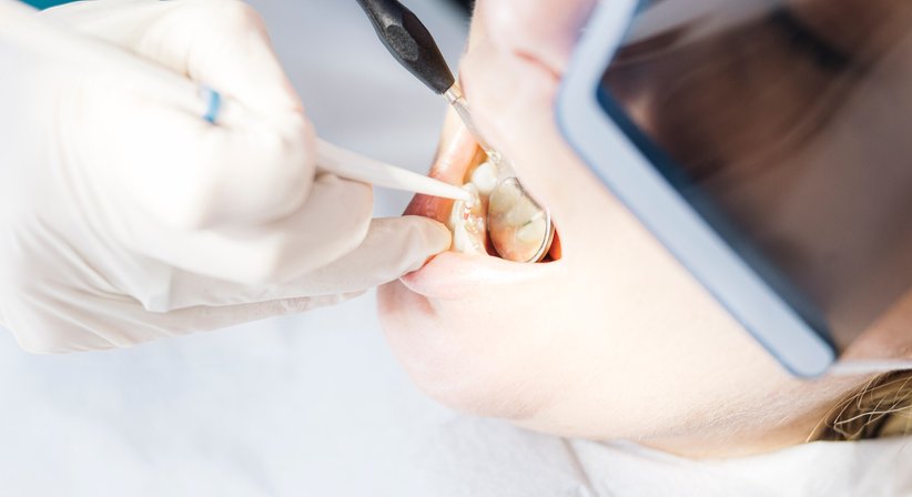 Konservierende Zahnheilkunde - Dr. Roberto Lhotka - Ordination Wien - Zahnarzt Wien 1010