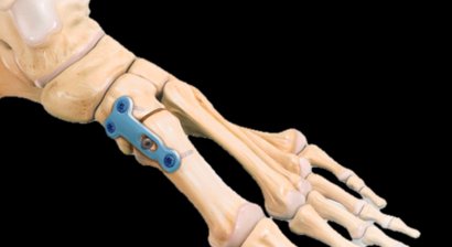 Fußchirurgie, Hüftchirurgie und Kinderorthopädie