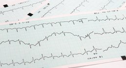 Dr. med. univ. Alketa Gaba - Internistin Wiener Neudorf 2351