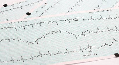 Herz-Kreislauf-Erkrankungen - Abklärung und Therapie