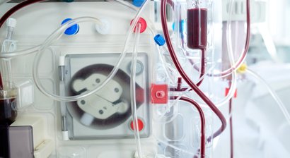 Dialyse-Shunt-Chirurgie