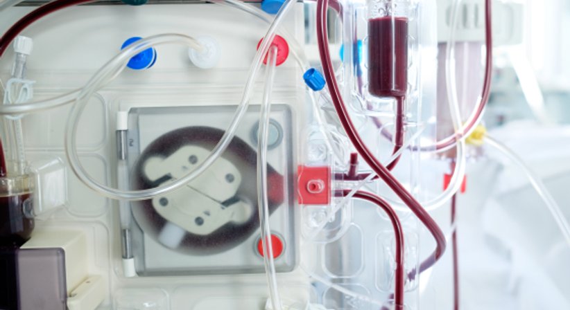 Dialyse-Shunt-Chirurgie - Assoc. Prof. Priv. Doz. Dr. Markus Klinger FEBVS - Gefäßchirurg Wien 1190