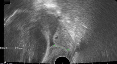 Betreuung nach Frühgeburten