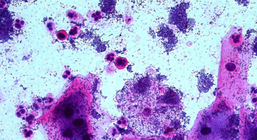 Betreuung von akuten Infektionen - Univ.Prof. Dr. Armin Witt - Frauenarzt Wien 1090