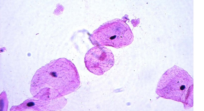 Betreuung von akuten Infektionen - Univ.Prof. Dr. Armin Witt - Frauenarzt Wien 1090