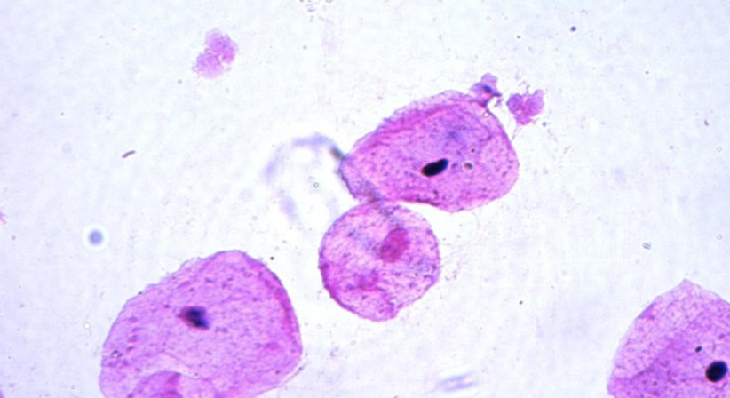 Betreuung von akuten Infektionen - Univ.Prof. Dr. Armin Witt - Frauenarzt Wien 1090