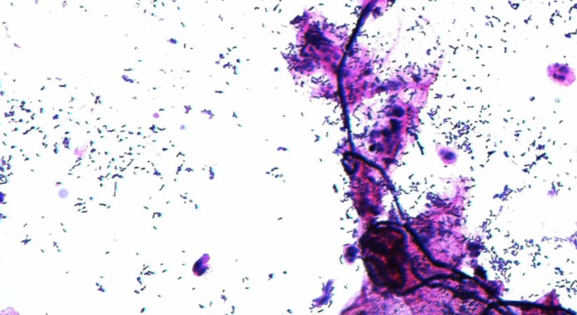 Betreuung von chronischen Infektionen - Univ.Prof. Dr. Armin Witt - Frauenarzt Wien 1090