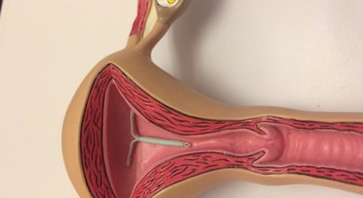 Familienplanung/Verhütung