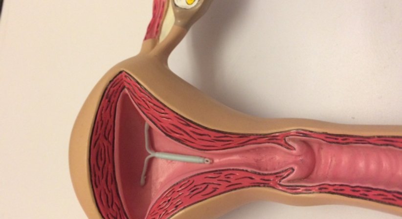 Familienplanung/Verhütung - Univ.Prof. Dr. Armin Witt - Frauenarzt Wien 1090