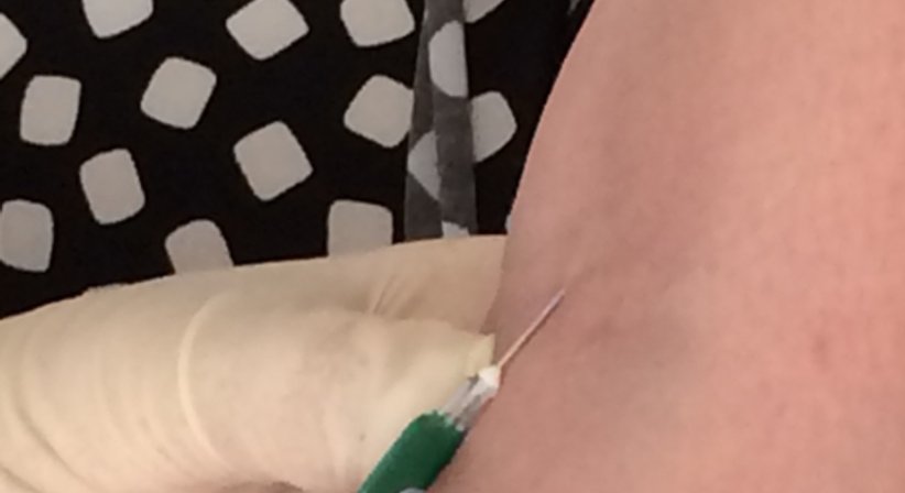 Kinderwunsch - Univ.Prof. Dr. Armin Witt - Frauenarzt Wien 1090