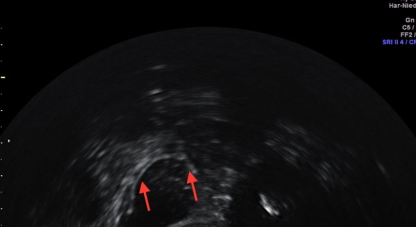 Kinderwunsch - Univ.Prof. Dr. Armin Witt - Frauenarzt Wien 1090