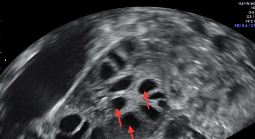 Kinderwunsch - Univ.Prof. Dr. Armin Witt - Frauenarzt Wien 1090