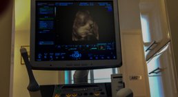 Univ.Prof. Dr. Armin Witt - Frauenarzt Wien 1090