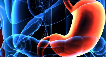 Magenbypass/Schlauchmagen (Sleeve-Gastrektomie)