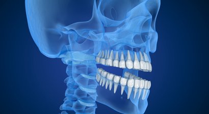 Digitale Zahntechnik / DVT Volumentomographie