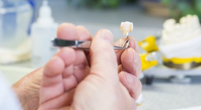 Inlays und Onlays aus Keramik