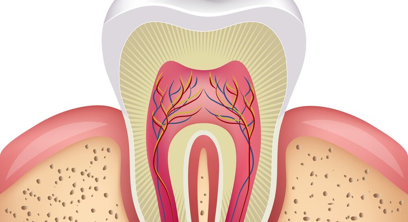 Wurzelspitzenresektion - DDr. Akos Feher - Zahnarzt Wien 1010