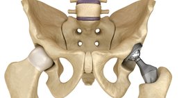 Dr. Thiago Tomazi, MSc. - Orthopäde 4910 Ried im Innkreis